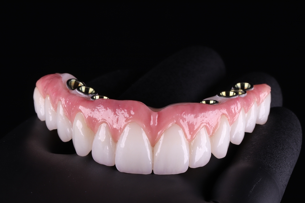 Folleto promocional de All-On Implants de Pelican Dental Care en Vero Beach, Florida. Incluye precios para una arcada y ambas arcas, con tarifas exclusivas para socios y detalles completos del paquete.